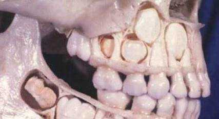 乳牙和恆牙的區別有哪些